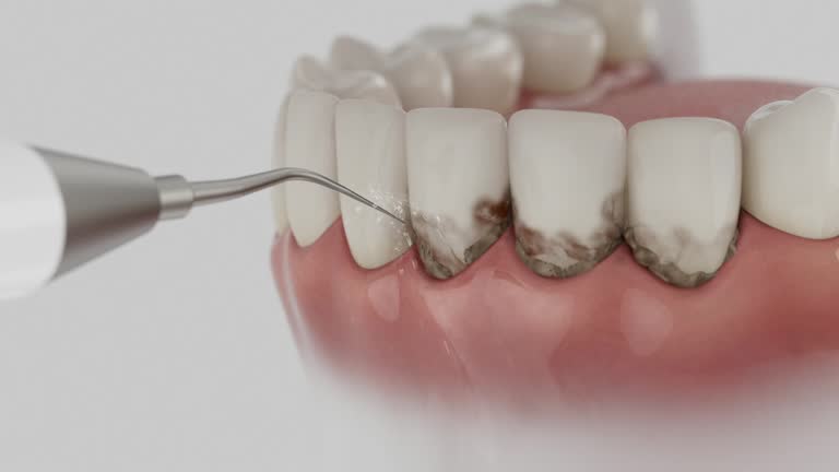 Reliable Dental Implants contractor in Genola, UT by Smile Center Dentistry